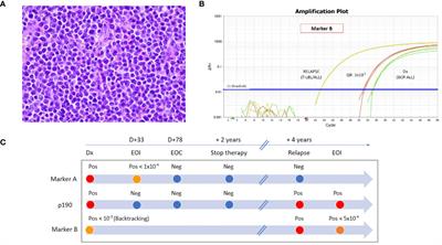 Case report: An intriguing case of Philadelphia chromosome–positive acute lymphoblastic leukemia recurrence